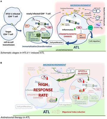 Future Perspectives on Drug Targeting in Adult T Cell Leukemia-Lymphoma